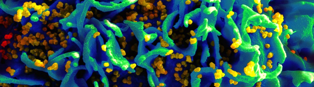 Living with AIDS. Written by Apple Gamboa for SubSelfie.com.