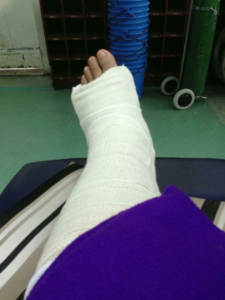 June 2013. My bones and muscles are weak, resulting to a hairline fracture on my left foot when I attempted to stand and walk to the door of my room. It took me 3 months before I could walk again. Back in August 2012, I had IJ catheter attached to the right side of my neck as temporary access for hemodialysis sessions. After 3 months, hemodialysis nurses were already using my av fistula, on my left arm. First insertion was during my 25th birthday. 